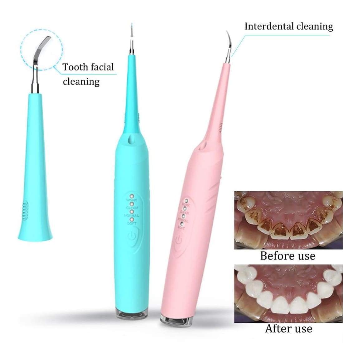 Dental calculus remover
