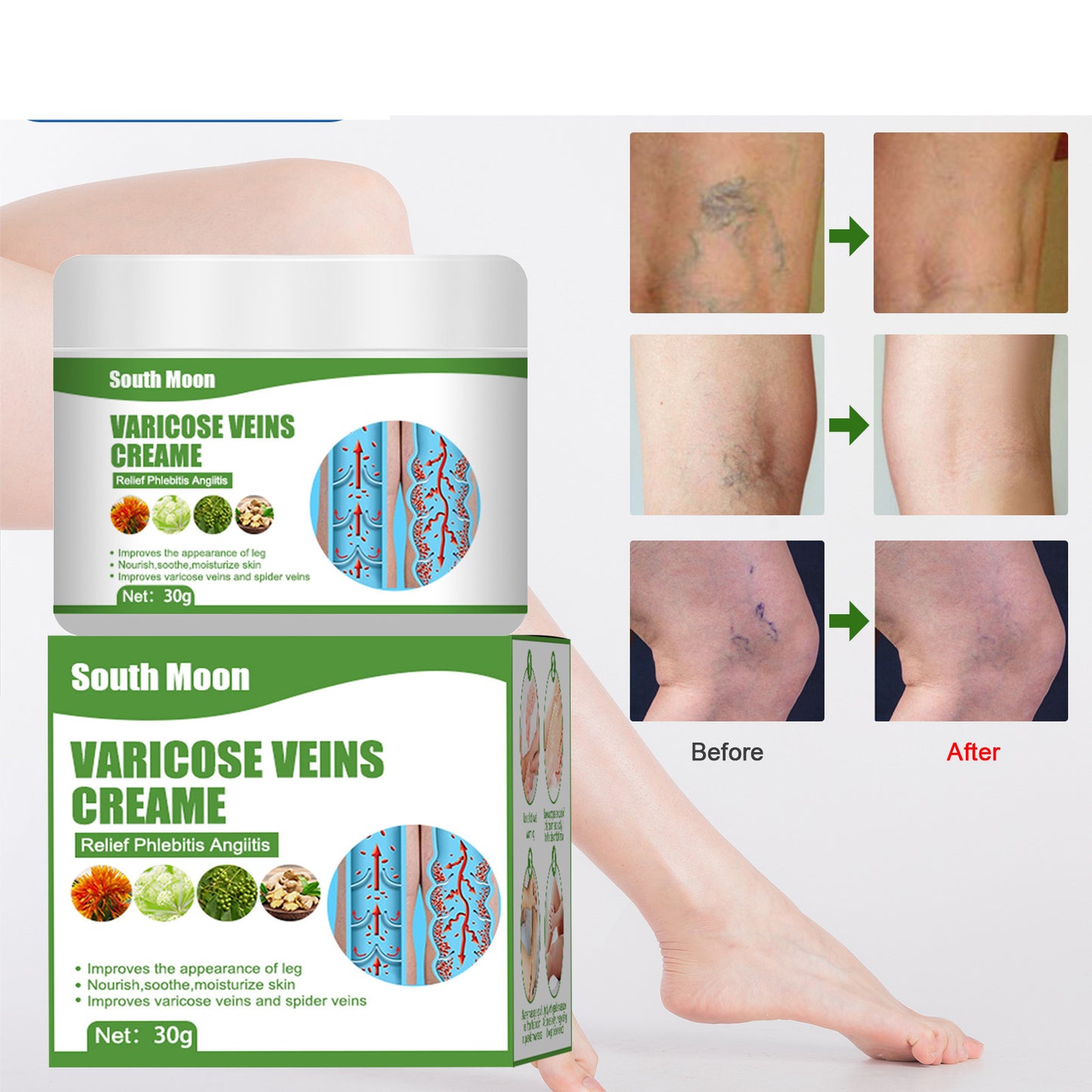 Varicose Veins Pain Relief Leg Massage Cream